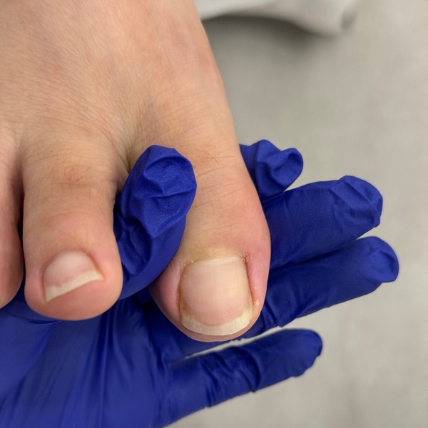 [부산 해운대] 닥터페디 해운대장산점 체험단